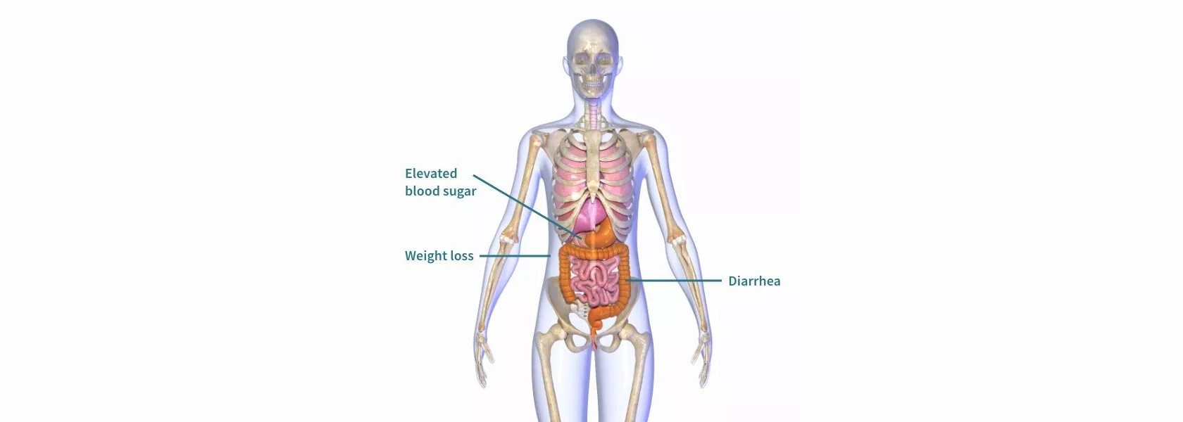 Somatostatinoma
